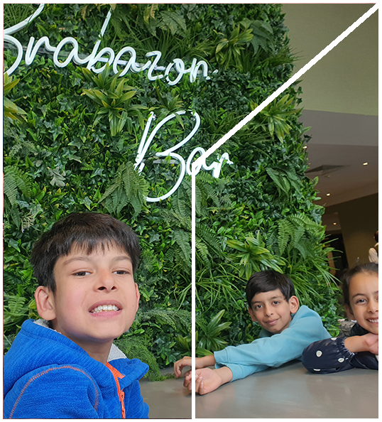 di george syndrome gallery