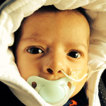 di george syndrome gallery 4