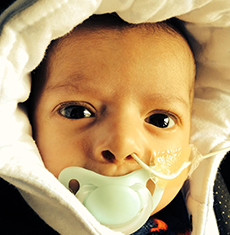 di george syndrome gallery 4